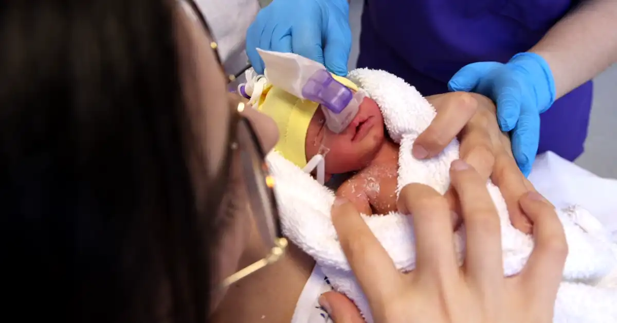 Możliwość przytulania przy stosowaniu CPAP na sali porodowej