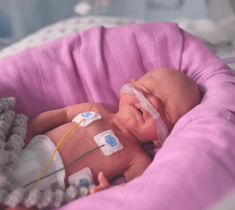 Neonate wearing a nasal cannula connected to one of Armstrong Medical's neonatal High Flow Oxygen Therapy circuits. Used in neonatal critical care where respiratory devices are needed.