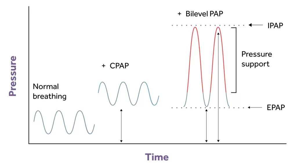 A graph showing the level of pressure for CPAP and BiLevel PAP